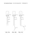 METHOD AND APPARATUS FOR RECONSTRUCTING A HIP JOINT, INCLUDING THE     PROVISION AND USE OF A NOVEL ARTHROSCOPIC DEBRIDEMENT TEMPLATE FOR     ASSISTING IN THE TREATMENT OF CAM-TYPE FEMOROACETABULAR IMPINGEMENT diagram and image