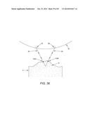 METHOD AND APPARATUS FOR RECONSTRUCTING A HIP JOINT, INCLUDING THE     PROVISION AND USE OF A NOVEL ARTHROSCOPIC DEBRIDEMENT TEMPLATE FOR     ASSISTING IN THE TREATMENT OF CAM-TYPE FEMOROACETABULAR IMPINGEMENT diagram and image