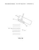 METHOD AND APPARATUS FOR RECONSTRUCTING A HIP JOINT, INCLUDING THE     PROVISION AND USE OF A NOVEL ARTHROSCOPIC DEBRIDEMENT TEMPLATE FOR     ASSISTING IN THE TREATMENT OF CAM-TYPE FEMOROACETABULAR IMPINGEMENT diagram and image