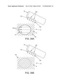 METHOD AND APPARATUS FOR RECONSTRUCTING A HIP JOINT, INCLUDING THE     PROVISION AND USE OF A NOVEL ARTHROSCOPIC DEBRIDEMENT TEMPLATE FOR     ASSISTING IN THE TREATMENT OF CAM-TYPE FEMOROACETABULAR IMPINGEMENT diagram and image