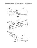 Surgical Disc Removal Tool diagram and image