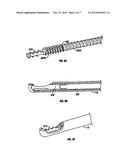 Surgical Disc Removal Tool diagram and image