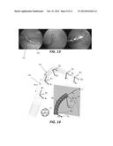 SYSTEMS AND METHODS FOR ROBOT-ASSISTED TRANSURETHRAL EXPLORATION AND     INTERVENTION diagram and image