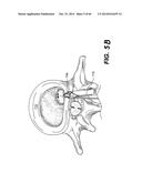 APPARATUS FOR THE TREATMENT OF TISSUE diagram and image