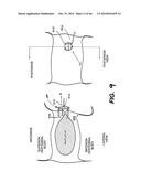 APPARATUS FOR THE TREATMENT OF TISSUE diagram and image