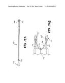 APPARATUS FOR THE TREATMENT OF TISSUE diagram and image