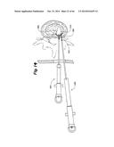 APPARATUS FOR THE TREATMENT OF TISSUE diagram and image