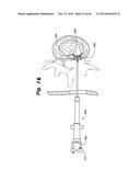 APPARATUS FOR THE TREATMENT OF TISSUE diagram and image