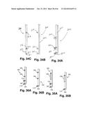 APPARATUS FOR THE TREATMENT OF TISSUE diagram and image