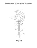 APPARATUS FOR THE TREATMENT OF TISSUE diagram and image