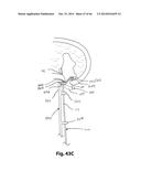 APPARATUS FOR THE TREATMENT OF TISSUE diagram and image