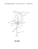 APPARATUS FOR THE TREATMENT OF TISSUE diagram and image