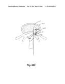 APPARATUS FOR THE TREATMENT OF TISSUE diagram and image