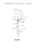 APPARATUS FOR THE TREATMENT OF TISSUE diagram and image