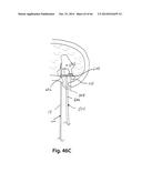 APPARATUS FOR THE TREATMENT OF TISSUE diagram and image