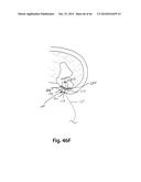 APPARATUS FOR THE TREATMENT OF TISSUE diagram and image