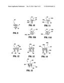 SURGICAL FASTENERS diagram and image