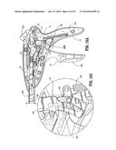 Surgical Stapling Device diagram and image