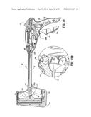 Surgical Stapling Device diagram and image