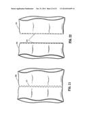 Surgical Stapling Device diagram and image