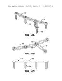 COMPRESSION BRACE diagram and image