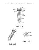 COMPRESSION BRACE diagram and image