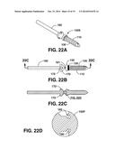 COMPRESSION BRACE diagram and image