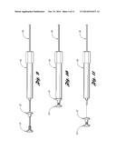 Bone Repair System and Method diagram and image