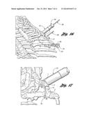 Bone Repair System and Method diagram and image