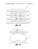 Bone Repair System and Method diagram and image