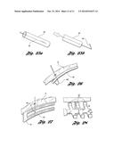 Bone Repair System and Method diagram and image