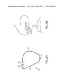 NASAL STIMULATION DEVICES AND METHODS diagram and image