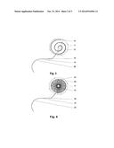 IMPLANTABLE INDIFFERENT ELECTRODE diagram and image