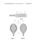 IMPLANTABLE INDIFFERENT ELECTRODE diagram and image