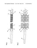 IMPLANT DELIVERY SYSTEM WITH MARKER INTERLOCK diagram and image