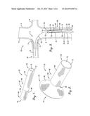 INTERCONNECTION BETWEEN SELECTIVELY-EXPANDABLE AND SELF-EXPANDABLE     SECTIONS OF AN OSTIAL STENT diagram and image