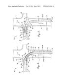 INTERCONNECTION BETWEEN SELECTIVELY-EXPANDABLE AND SELF-EXPANDABLE     SECTIONS OF AN OSTIAL STENT diagram and image