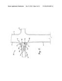 INTERCONNECTION BETWEEN SELECTIVELY-EXPANDABLE AND SELF-EXPANDABLE     SECTIONS OF AN OSTIAL STENT diagram and image