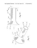 INTERCONNECTION BETWEEN SELECTIVELY-EXPANDABLE AND SELF-EXPANDABLE     SECTIONS OF AN OSTIAL STENT diagram and image