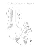 INTERCONNECTION BETWEEN SELECTIVELY-EXPANDABLE AND SELF-EXPANDABLE     SECTIONS OF AN OSTIAL STENT diagram and image