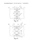 INTERCONNECTION BETWEEN SELECTIVELY-EXPANDABLE AND SELF-EXPANDABLE     SECTIONS OF AN OSTIAL STENT diagram and image