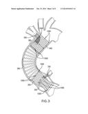 HEART VALVE AND ENDOVASCULAR GRAFT COMPONENTS AND METHOD FOR DELIVERY diagram and image