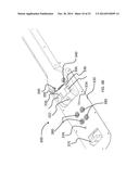 STABILIZING APPARATUS FOR HIGHLY ARTICULATED PROBES WITH LINK ARRANGEMENT,     METHODS OF FORMATION THEREOF, AND METHODS OF USE THEREOF diagram and image