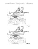 VEHICLE UNDERBELLY SYSTEM diagram and image