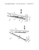 DISSECTING TIP FOR SURGICAL STAPLER diagram and image