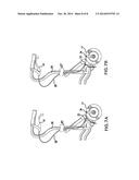 Foldable Walking Stabilizer Device diagram and image