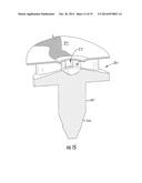 Double Fabric Faced Injection Molded Fixture diagram and image