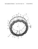 COIL RETAINER FOR ELECTRIC MACHINE ROTORS diagram and image