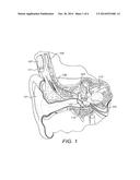 Lower Q Point Floating Mass Transducer diagram and image