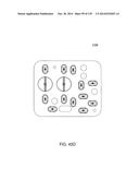 HEMODIALYSIS SYSTEMS AND METHODS diagram and image